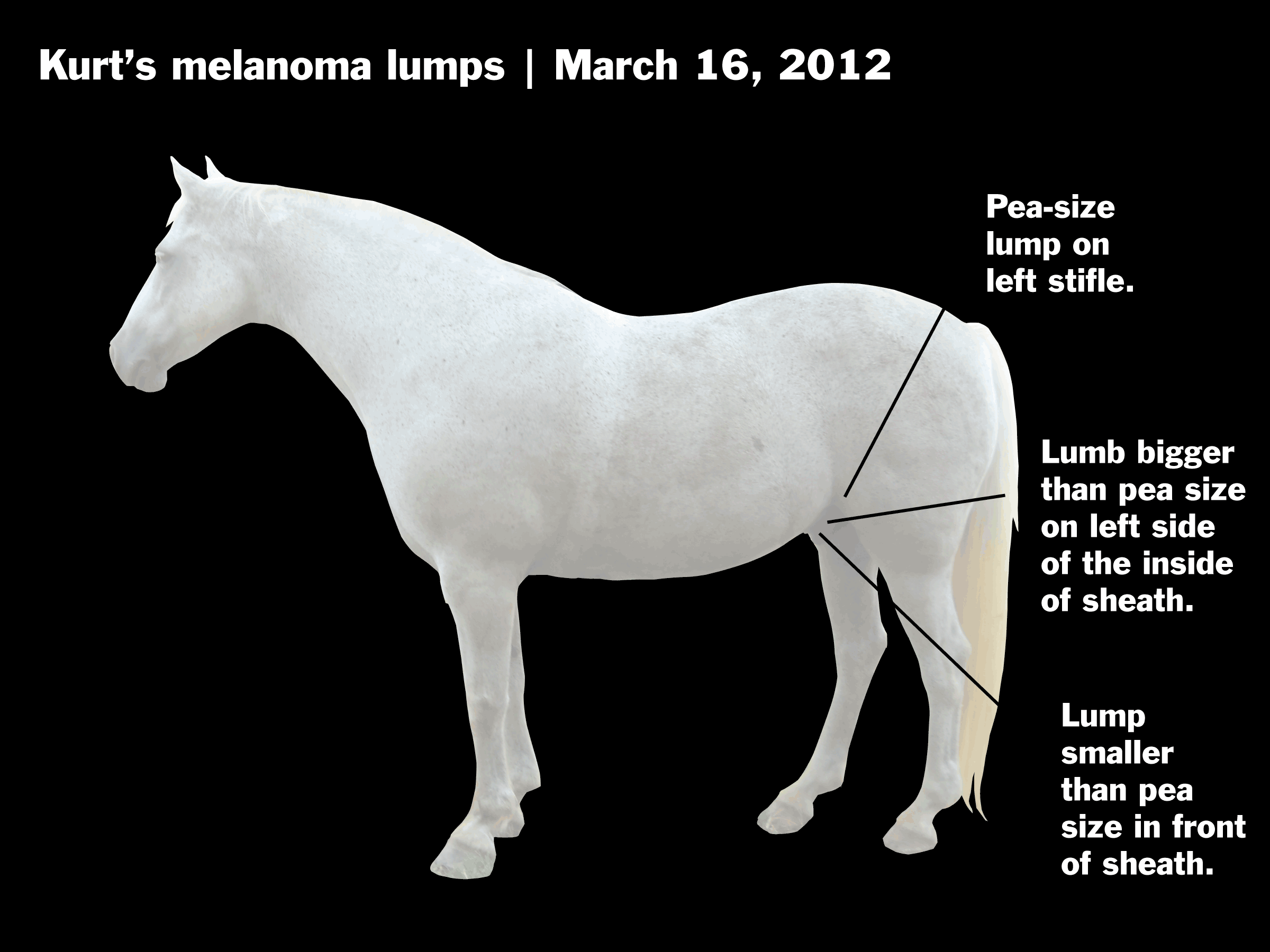 melanoma lumps